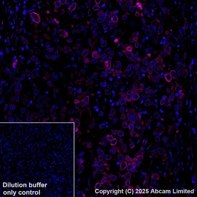 Anti-Cytokeratin 19 PE antibody [EP1580Y] (ab224981) IgG | Abcam