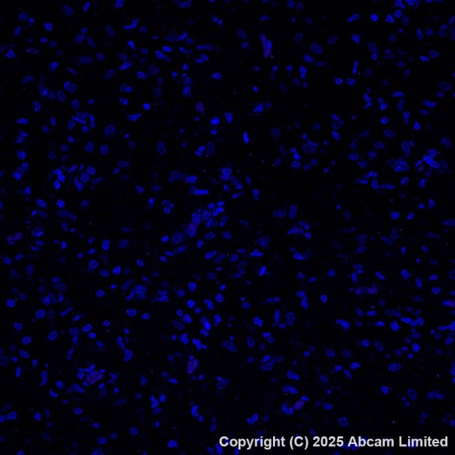 Immunohistochemistry paraffin embedded sections - PE Anti-Cytokeratin 19 antibody [EP1580Y] (AB224981)