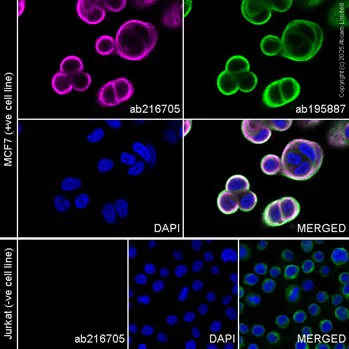 Immunocytochemistry/ Immunofluorescence - PE Anti-Cytokeratin 19 antibody [EPR1579Y] (AB216705)
