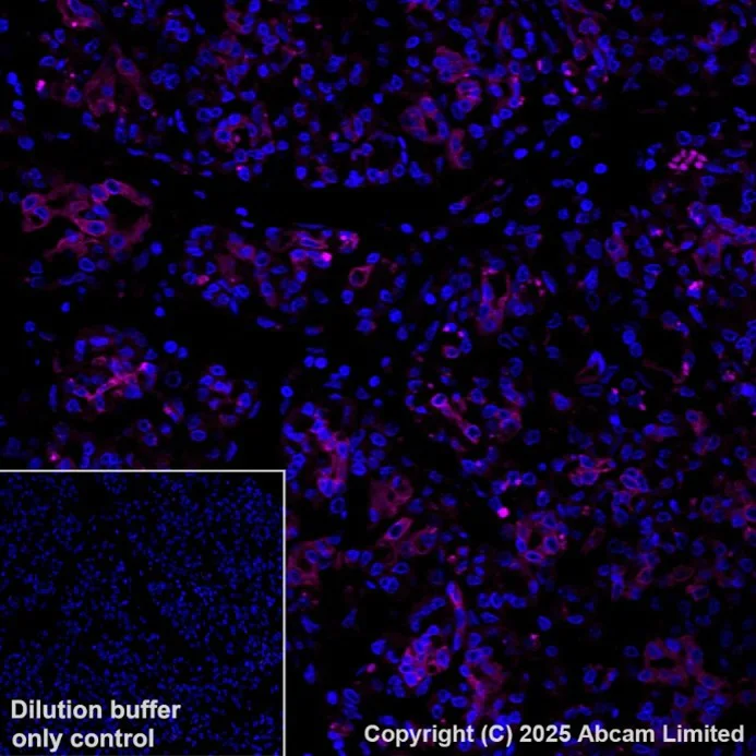 Immunohistochemistry (Formalin/PFA-fixed paraffin-embedded sections) - PE Anti-Cytokeratin 19 antibody [EPR1579Y] (AB216705)