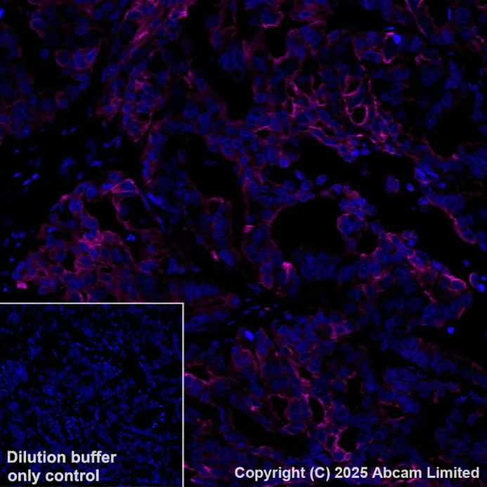 Immunohistochemistry (Formalin/PFA-fixed paraffin-embedded sections) - PE Anti-Cytokeratin 19 antibody [EPR1579Y] (AB216705)