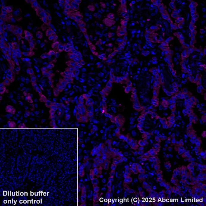 Immunohistochemistry (Formalin/PFA-fixed paraffin-embedded sections) - PE Anti-Cytokeratin 19 antibody [EPR1579Y] (AB216705)