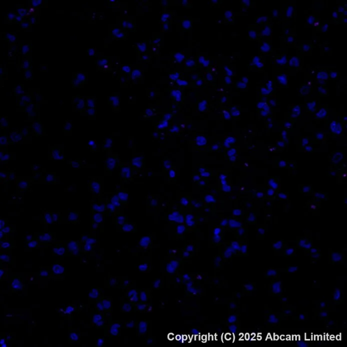 Immunohistochemistry (Formalin/PFA-fixed paraffin-embedded sections) - PE Anti-Cytokeratin 19 antibody [EPR1579Y] (AB216705)