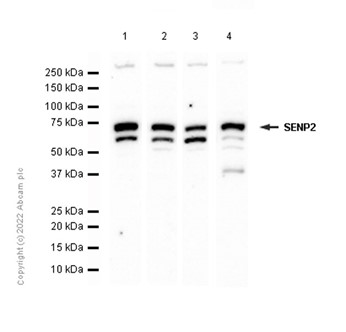 Western blot - PE Anti-ENPP3/B10 antibody [NP4D6] (AB90751), expandable thumbnail