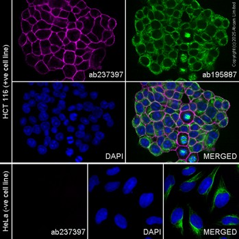 Immunohistochemistry paraffin embedded sections - PE Anti-EpCAM antibody [EPR20532-225] (AB237397)