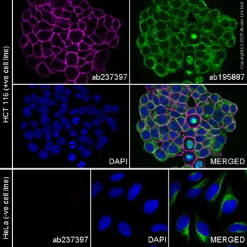 Immunohistochemistry paraffin embedded sections - PE Anti-EpCAM antibody [EPR20532-225] (AB237397)