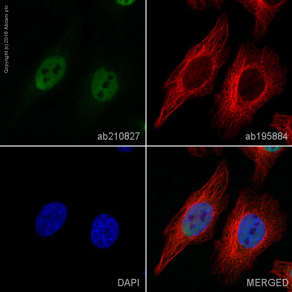 Immunocytochemistry/ Immunofluorescence - PE Anti-HDAC2 antibody [Y461] (AB210827)