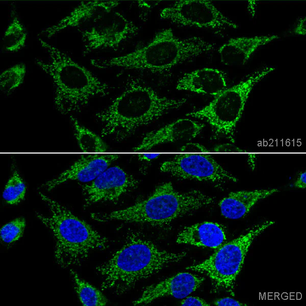 Immunocytochemistry/ Immunofluorescence - PE Anti-IGFBP7 antibody [EPR11912(B)] (AB211615)
