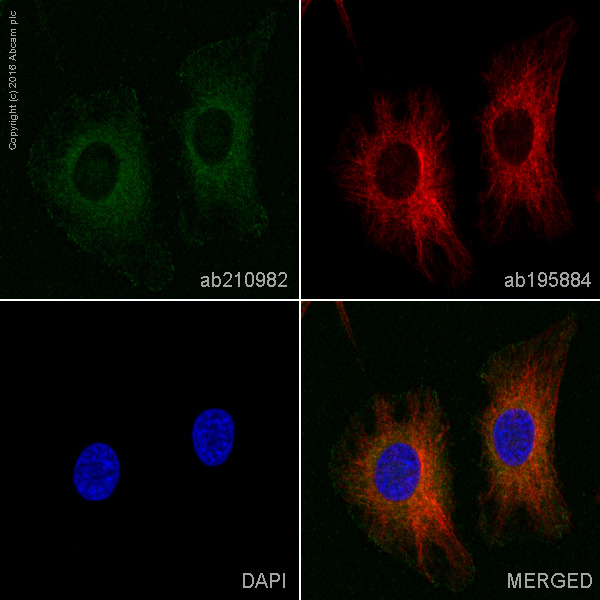 Immunocytochemistry/ Immunofluorescence - PE Anti-MALT1/MLT antibody [EP603Y] (AB210982)