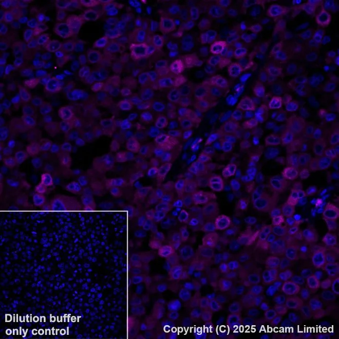 Immunohistochemistry paraffin embedded sections - PE Anti-MelanA antibody [EPR20380] (AB225499)