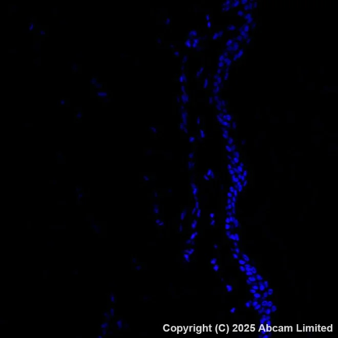 Immunohistochemistry paraffin embedded sections - PE Anti-MelanA antibody [EPR20380] (AB225499)