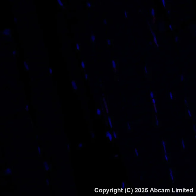 Immunohistochemistry paraffin embedded sections - PE Anti-MelanA antibody [EPR20380] (AB225499)