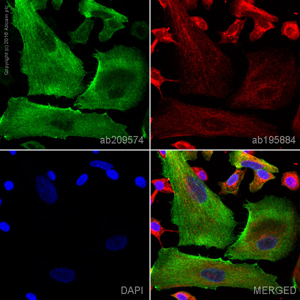 Immunocytochemistry/ Immunofluorescence - PE Anti-MMP1 antibody [EP1247Y] (AB209574), expandable thumbnail