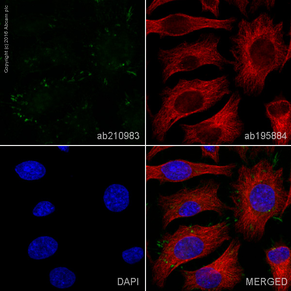 Immunocytochemistry/ Immunofluorescence - PE Anti-Moesin antibody [EP1863Y] (AB210983), expandable thumbnail