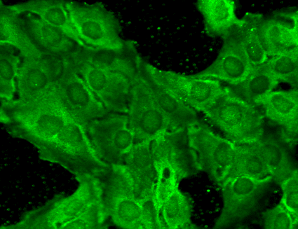 Immunocytochemistry/ Immunofluorescence - PE Anti-NMDAR2B antibody [S59] (AB274365), expandable thumbnail