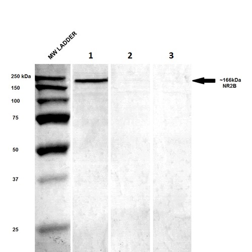 Western blot - PE Anti-NMDAR2B antibody [S59] (AB274365), expandable thumbnail