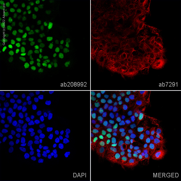 Immunocytochemistry/ Immunofluorescence - PE Anti-p53 antibody [E47] (AB208992)