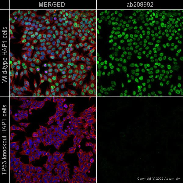 Immunocytochemistry/ Immunofluorescence - PE Anti-p53 antibody [E47] (AB208992)
