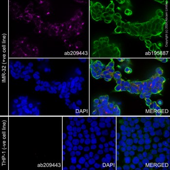 Immunocytochemistry/ Immunofluorescence - PE Anti-Pan Trk antibody [EP1058Y] (AB209443)