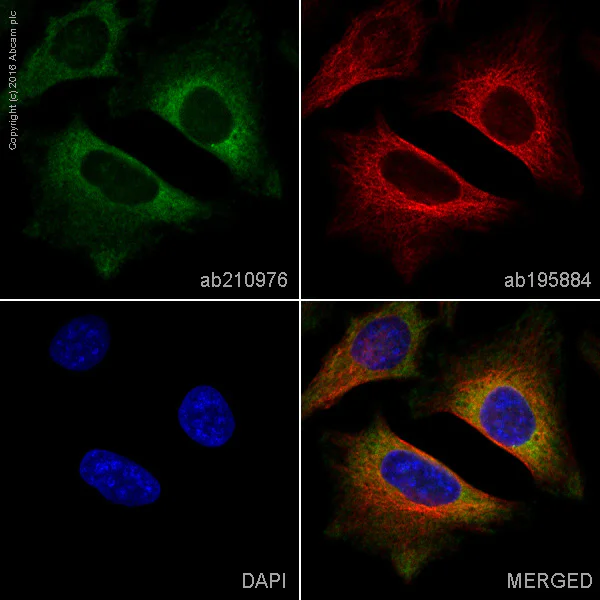 Immunocytochemistry/ Immunofluorescence - PE Anti-PKC beta 2 antibody [Y125] (AB210976)