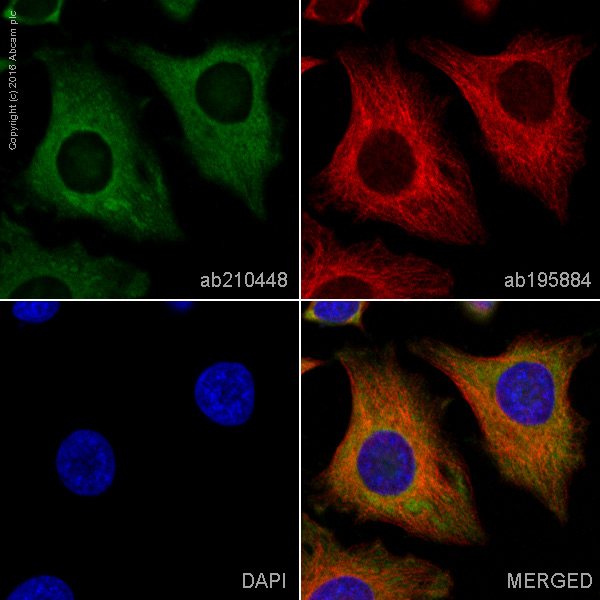 Immunocytochemistry/ Immunofluorescence - PE Anti-PKM antibody [EPR10138(B)] (AB210448)