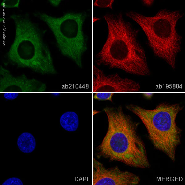Immunocytochemistry/ Immunofluorescence - PE Anti-PKM antibody [EPR10138(B)] (AB210448)