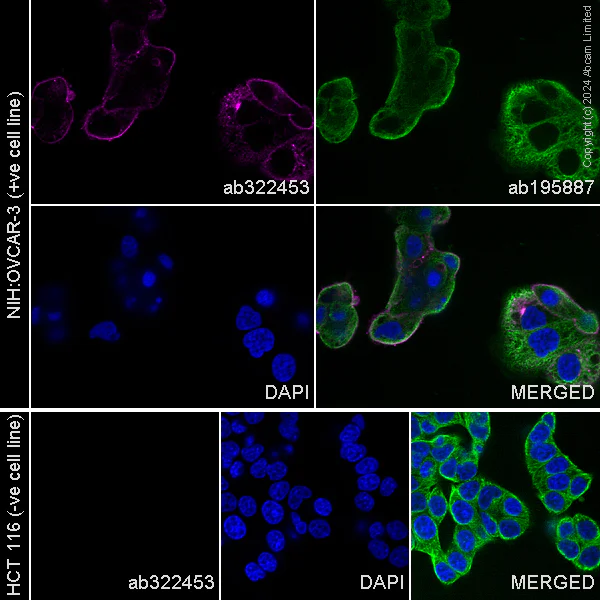 Immunocytochemistry/ Immunofluorescence - PE Anti-SLC34A2 antibody [SP322] - N-terminal (AB322453)