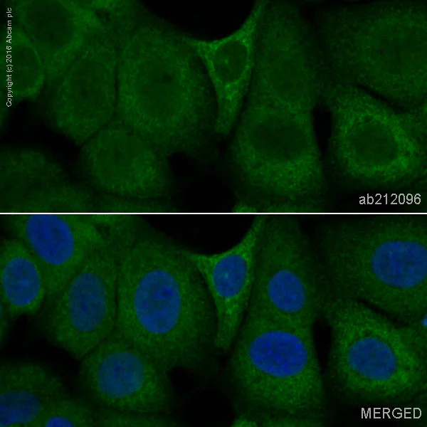 Immunocytochemistry/ Immunofluorescence - PE Anti-Smad2 antibody [EP784Y] (AB212096)