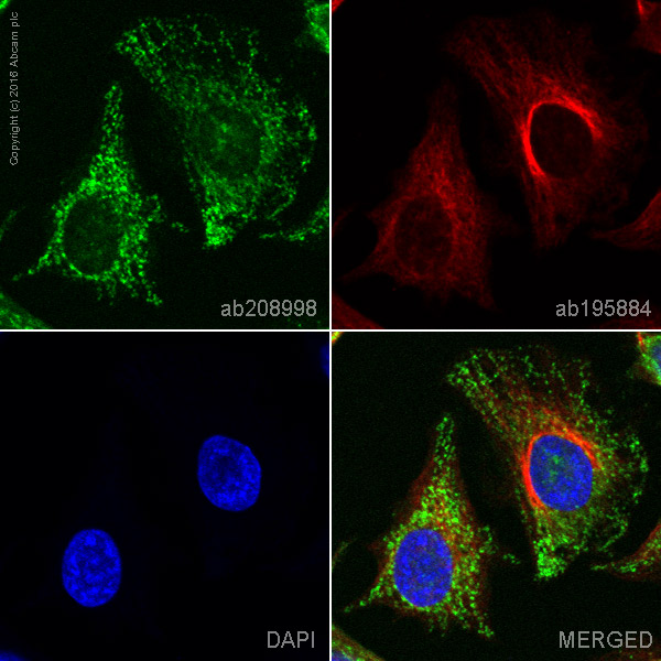 Immunocytochemistry/ Immunofluorescence - PE Anti-Thymidine Kinase 1/TK1 antibody [EPR3194] (AB208998), expandable thumbnail