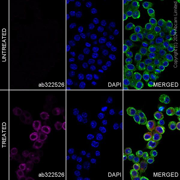 Immunocytochemistry/ Immunofluorescence - PE Anti-TNF alpha antibody [EPR21753-109] (AB322526)