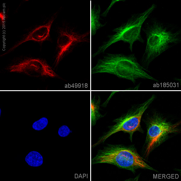 Immunocytochemistry/ Immunofluorescence - PE Anti-Vimentin antibody [VI-RE/1] (AB49918), expandable thumbnail