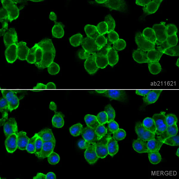 Immunocytochemistry/ Immunofluorescence - PE Anti-Ym-1 + Ym-2 antibody [EPR15263] (AB211621)