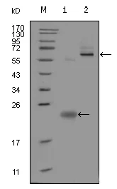 Western blot - Anti-Pea3 antibody [1A2G3] (AB70425)