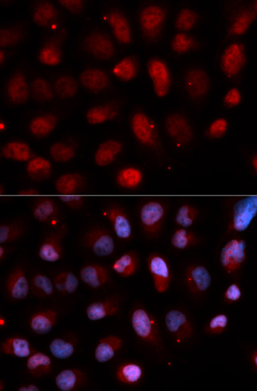 Immunocytochemistry/ Immunofluorescence - Anti-Pea3 antibody (AB189826)