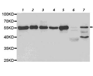 Western blot - Anti-Pea3 antibody (AB189826)