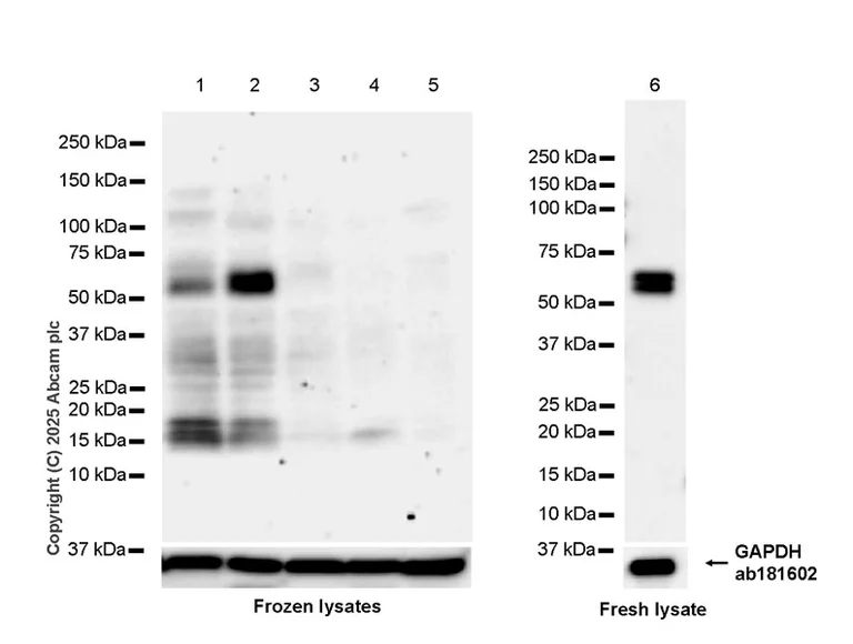 Western blot - Anti-Pea3 antibody [EPR30314-30] (AB323843)