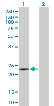 Western blot - Anti-PEAMT antibody (AB172388), expandable thumbnail
