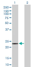 Western blot - Anti-PEAMT antibody (AB172388)