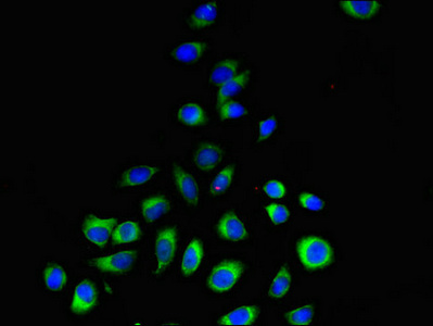 Immunocytochemistry/ Immunofluorescence - Anti-PEAMT antibody (AB237686)