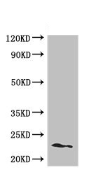 Western blot - Anti-PEAMT antibody (AB237686)