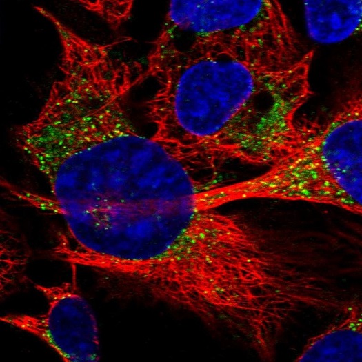 Immunocytochemistry/ Immunofluorescence - Anti-PECI/ECI2 antibody (AB224441), expandable thumbnail