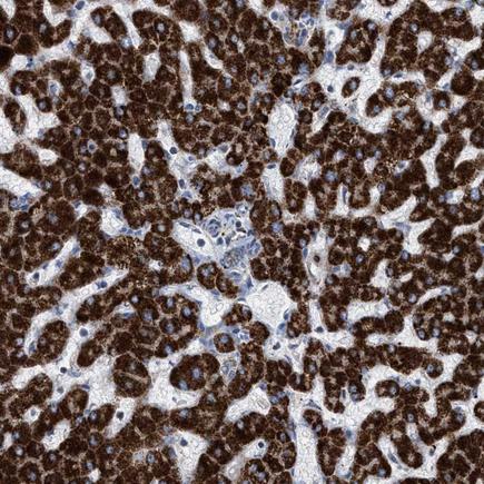 Immunohistochemistry (Formalin/PFA-fixed paraffin-embedded sections) - Anti-PECI/ECI2 antibody (AB224441), expandable thumbnail
