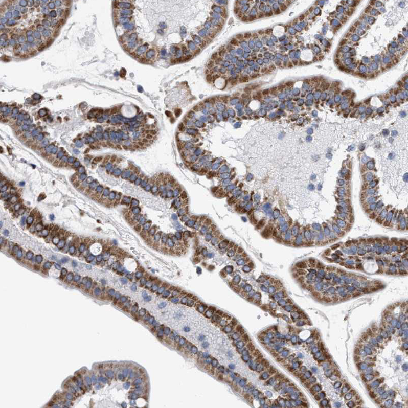 Immunohistochemistry (Formalin/PFA-fixed paraffin-embedded sections) - Anti-PECI/ECI2 antibody (AB224441), expandable thumbnail