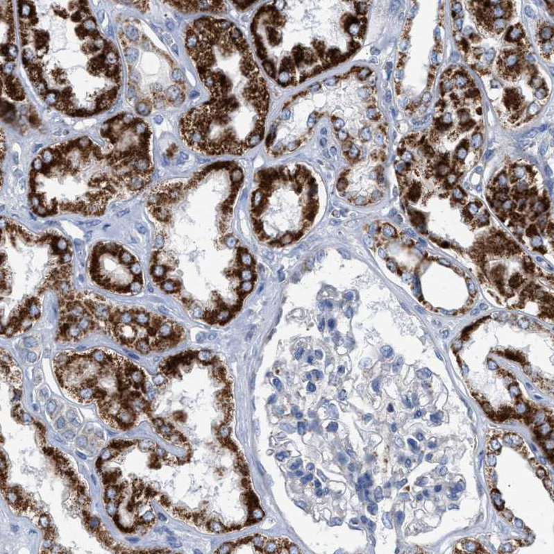 Immunohistochemistry (Formalin/PFA-fixed paraffin-embedded sections) - Anti-PECI/ECI2 antibody (AB224441), expandable thumbnail