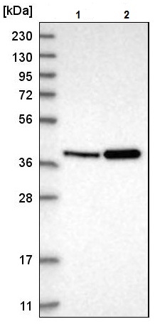 Western blot - Anti-PECI/ECI2 antibody (AB224441), expandable thumbnail