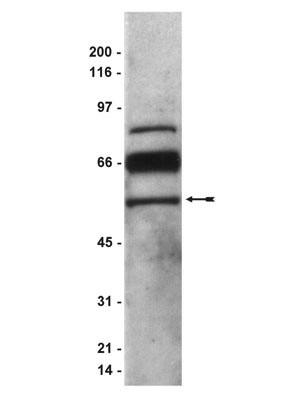 Western blot - Anti-PEDF antibody (AB14993), expandable thumbnail