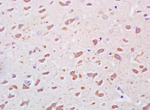 Immunohistochemistry (Formalin/PFA-fixed paraffin-embedded sections) - Anti-PEDF antibody (AB203033)