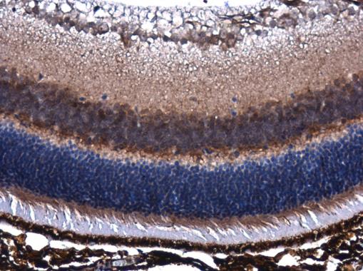 Immunohistochemistry (Formalin/PFA-fixed paraffin-embedded sections) - Anti-PEDF antibody (AB227295)