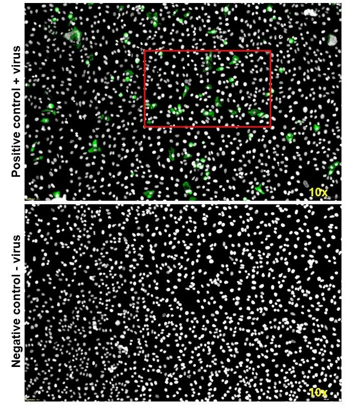 Immunocytochemistry/ Immunofluorescence - Anti-PEDV antibody [2F7] (AB325988)