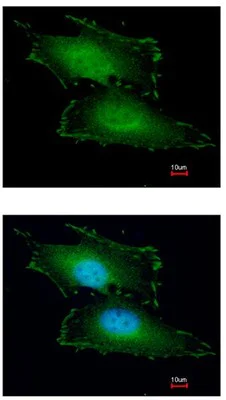 Immunocytochemistry/ Immunofluorescence - Anti-PEF1 antibody (AB96132)